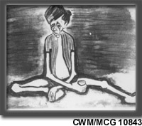 Belsen Concentration Camp - Malnutrition CWM/MCG 10843