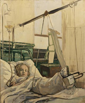 Enfant victime d'un bombardement recevant un traitement  la pnicilline , Ethel Gabain, Imperial War Museum, ART LD 5775