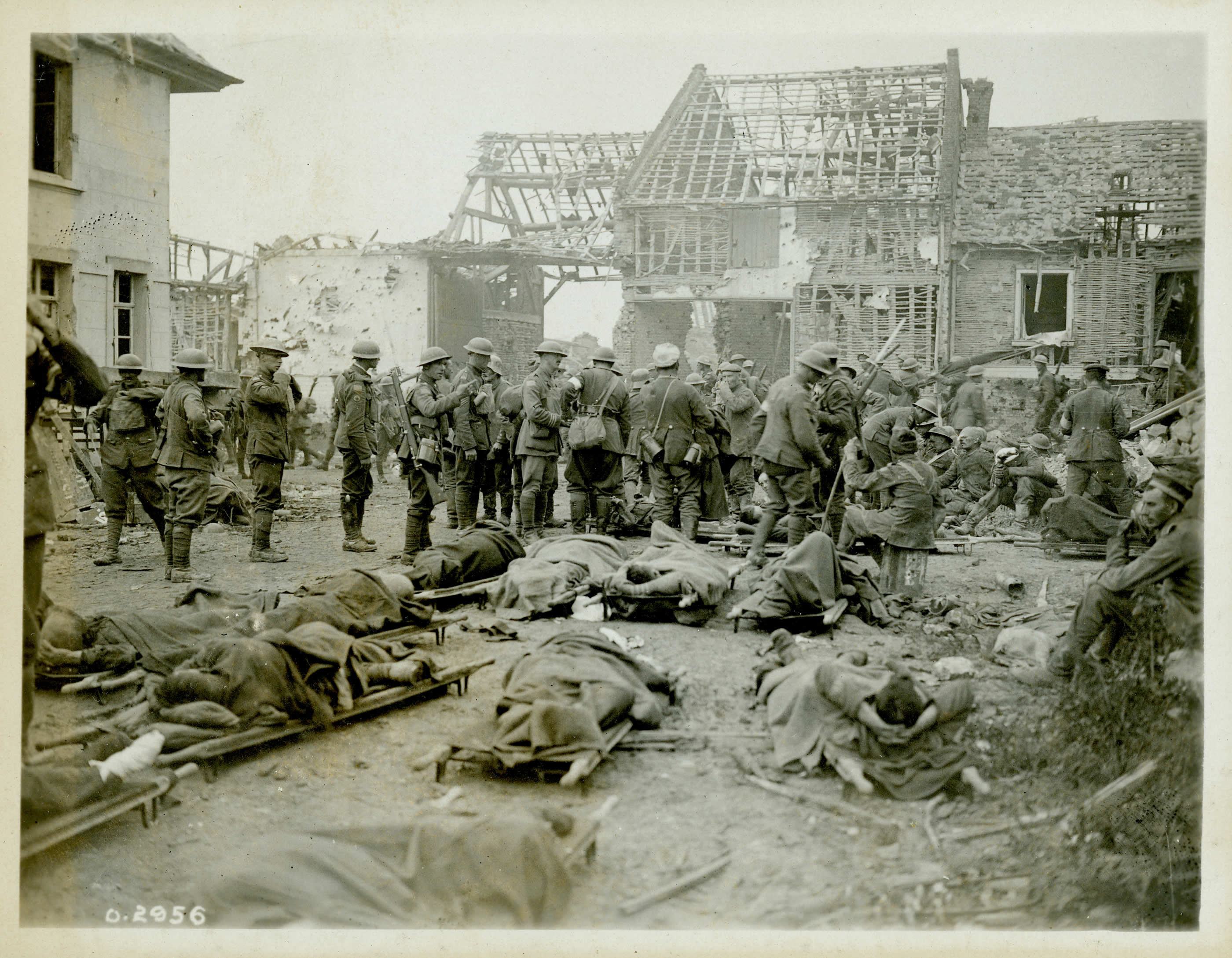 Wounded at Amiens